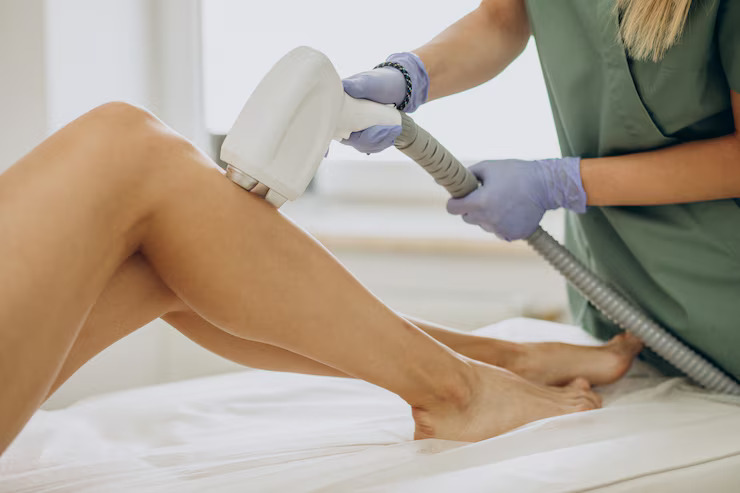 laser-hair-removal-treatment-in-vadodara